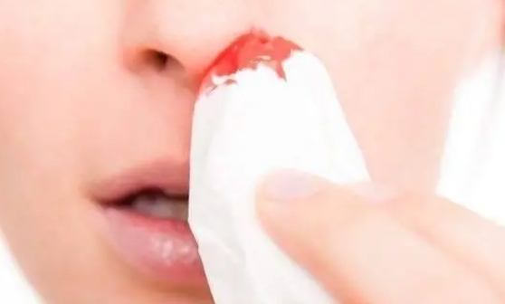 6歲孩子習慣性鼻出血 竟是頻繁挖鼻孔惹的禍